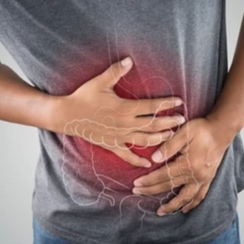 Tips Mengatasi Gangguan Pencernaan Selama Umroh